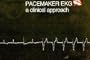 Pacemaker EKG: A Clinical Approach