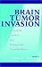 Brain Tumor Invasion: Biological, Clinical, and Therapeutic Considerations