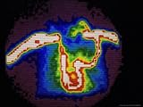Nuclear Medicine-Gamma Camera Scan Showing Occlusion of Venacava, Heart in Lower Center Photographic Poster Print by David M. Dennis, 24x18