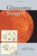 Glaucoma Surgery (Book & DVD)