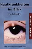 Bild zu: Hautkrankheiten im Blick. Ein Fotoatlas. F&uuml;r die Kitteltasche