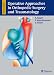 Operative Approaches in Orthopedic Surgery and Traumatology