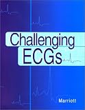 Challenging ECGs
