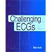 Challenging ECGs