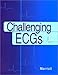 Challenging ECGs