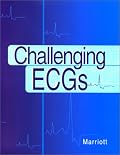 Challenging ECGs