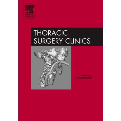 Lung Surgery Comlications: Prevention and Management