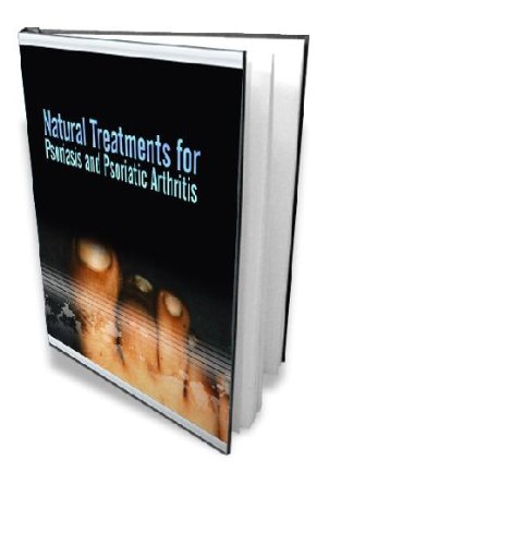 psoriatic arthritis