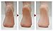 Callus Remover Electric by PediSoft - Rechargeable - Our Lifetime Guarantee Protects Your Investment - Easily File Foot, Eliminates Dead, Coarse, Rough Skin - Perfect Gift
