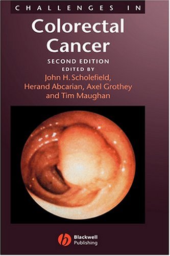 Colorectal-Cancer