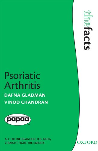 psoriatic arthritis