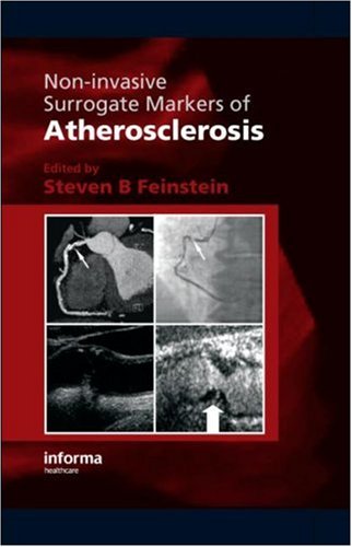 Non-Invasive Surrogate Markers of Atherosclerosis B. Feinstein Steven