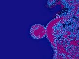 HIV AIDS Virus. Acquired Immune Deficiency Syndrome Photographic Poster Print, 32x24