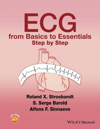 ECG from Basics to Essentials: Step