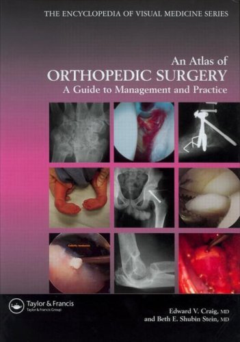 Atlas of Orthopedic Surgery (Encyclopedia of Visual Medicine) On Sale