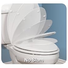 Mayfair 20SLOWC 000 Slow-Close Plastic Toilet Seat with Lift-Off Hinges, STA-TITE Seat Fastening System and DuraGuard Antimicrobial, Round, White