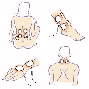 Smart TENS - Digital, dual channel pain relief TENS