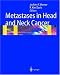 Metastases in Head and Neck Cancer