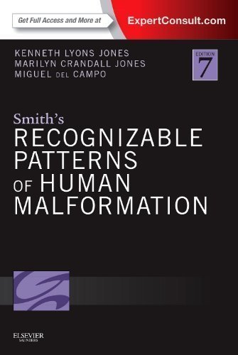 Smith's Recognizable Patterns of Human Malformation: Expert Consult - Online and Print, 7e by Jones MD, Kenneth Lyons Published by Saunders 7th (seventh) edition (2013) Hardcover