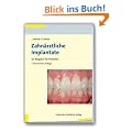 Zahn�rztliche Implantate: Ein Ratgeber f�r Patienten