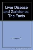 Liver disease and gallstones : the facts