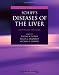 Schiff s Diseases of the Liver (Diseases of the Liver (Schiff))