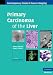 Primary Carcinomas of the Liver (Contemporary Issues in Cancer Imaging)