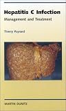 Books : Hepatitis C Infection: Management and Treatment