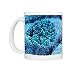 Col. SEM of eye melanocyte cell andamp;amp; pigment granules Photo Mugs
