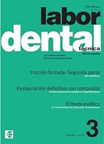 Labor Dental Técnica 3-2014 (Spanish Edition) Labor Dental Técnica 3-2014 (Spanish Edition)