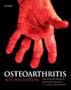 Osteoarthritis (Oxford Medical Publications)