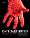 Book Osteoarthritis (Oxford Medical Publications)