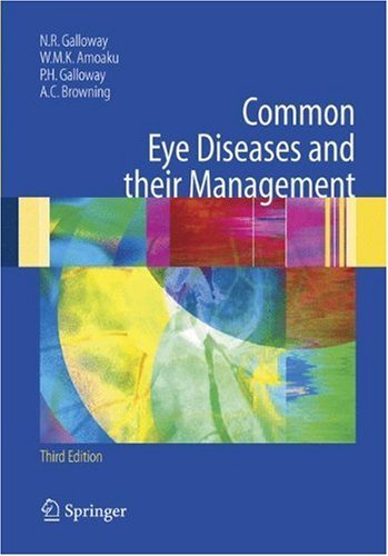 Common Eye Diseases and their Management