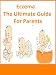 ECZEMA - The Ultimate Guide for Parents 41J8NWUg1 L. SL75 Solutions for Acne