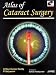 Search : Atlas of Cataract Surgery (With DVD- ROM)