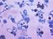 Cryptococcus Neoformans Brain Silver Stain Photographic Poster Print, 16x12