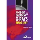 Accident and Emergency X-Rays Made Easy by James D. Begg
