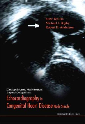 Congenital-Heart-Disease