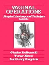 Vaginal Operations: Surgical Anatomy and Technique
