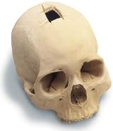 Trephined Cranium W/Stand Antique Finish