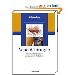 VenenChirurgie