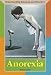 Book Understanding Diseases and Disorders - Anorexia (Understanding Diseases and Disorders)
