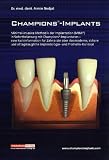 Champions-Implants - Das MIMI-Verfahren