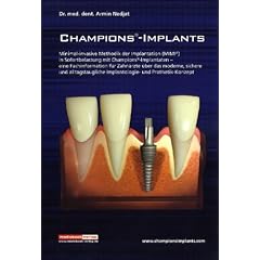Champions-Implants - Das MIMI-Verfahren