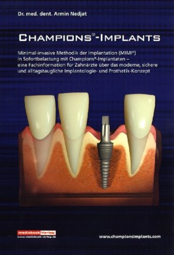 Champions-Implants - Das MIMI-Verfahren