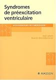 Les syndromes de pr�excitation ventriculaire