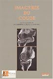 Imagerie du coude