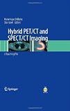 Hybrid PET/CT and SPECT/CT Imaging: A Teaching File