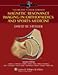 Magnetic Resonance Imaging in Orthopaedics and Sports Medicine