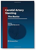 Carotid Artery Stenting: The Basics (Contemporary Cardiology)